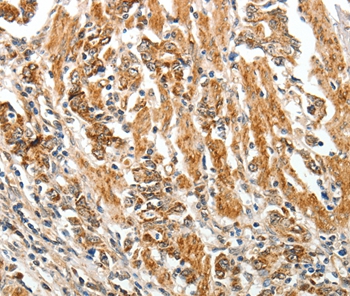 Rabbit Polyclonal Antibody to TGFBR1