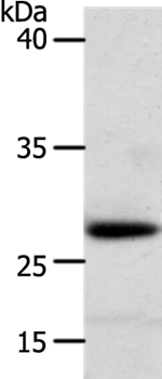 Rabbit Polyclonal Antibody to RARRES1