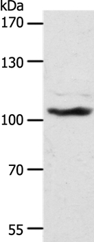 Rabbit Polyclonal Antibody to ADAMTS17