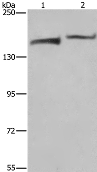 Rabbit Polyclonal Antibody to KDM5B