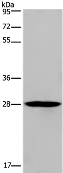 Rabbit Polyclonal Antibody to KLRF1