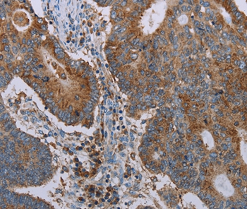 Rabbit Polyclonal Antibody to CYP7A1