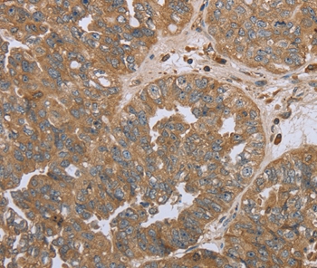Rabbit Polyclonal Antibody to NPR2