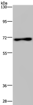 Rabbit Polyclonal Antibody to TIPARP