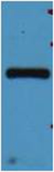 Rabbit Polyclonal Antibody to mStrawberry Rabbit