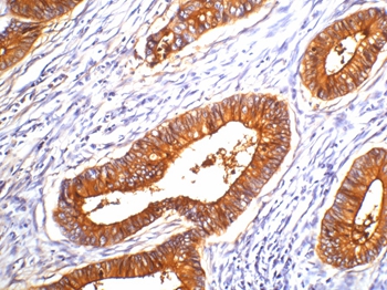 Mouse Monoclonal Antibody to Carcinoembryonic Antigen