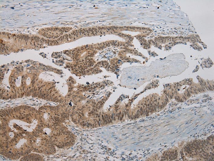Rabbit Polyclonal Antibody to ROBO3