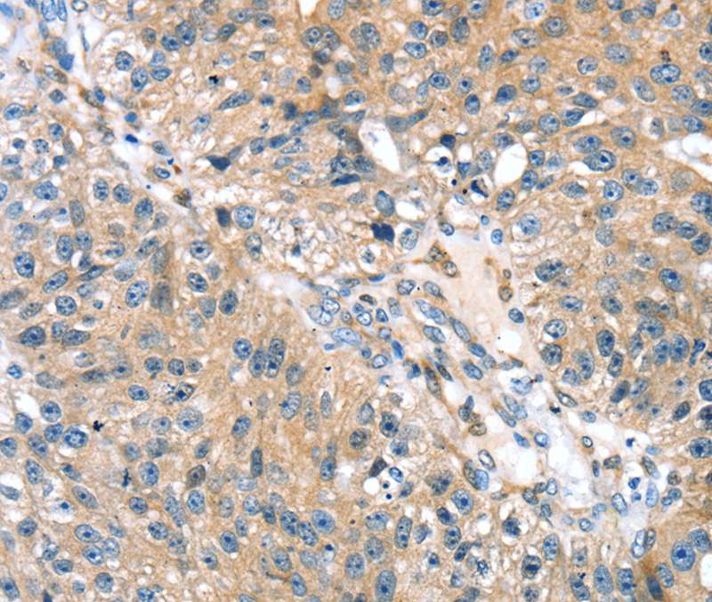 Rabbit Polyclonal Antibody to STXBP4