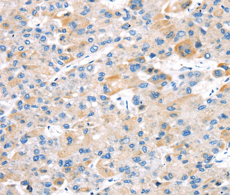 Rabbit Polyclonal Antibody to TBRG1