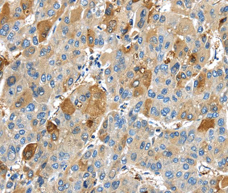 Rabbit Polyclonal Antibody to TNFAIP2