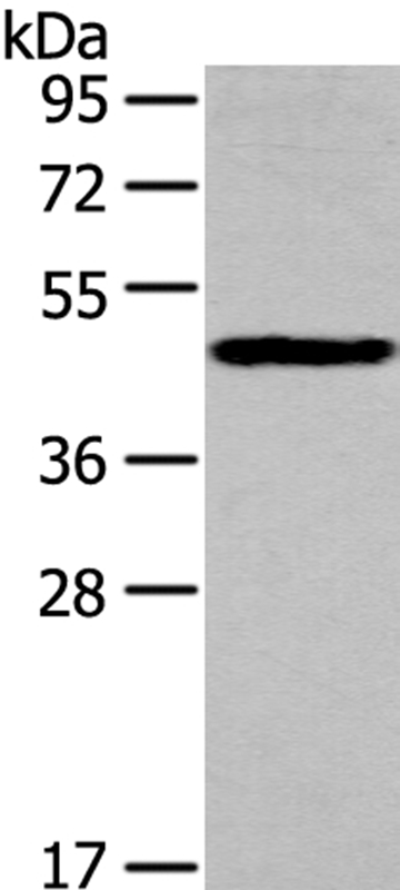 Rabbit Polyclonal Antibody to IL3RA