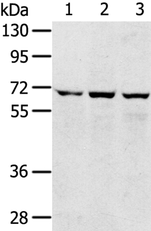 Rabbit Polyclonal Antibody to SLC5A9