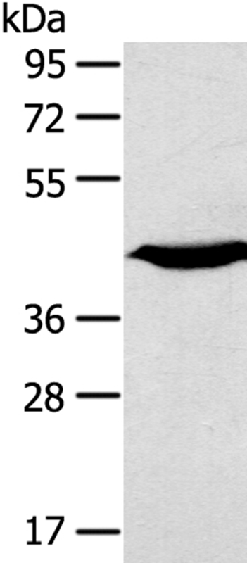 Rabbit Polyclonal Antibody to KCNK3