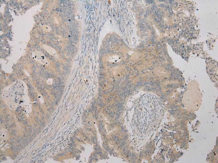 Rabbit Polyclonal Antibody to TSPY1