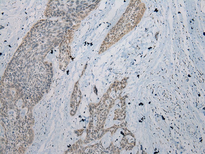 Rabbit Polyclonal Antibody to IL-2