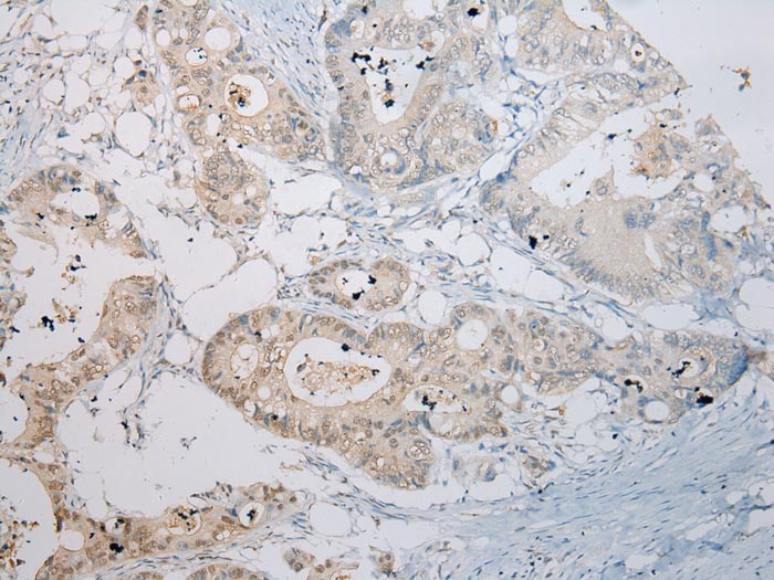 Rabbit Polyclonal Antibody to RASSF3