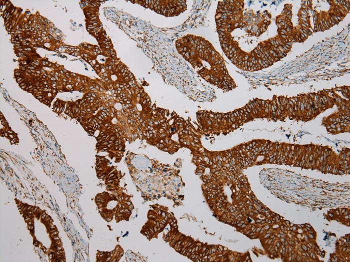 Rabbit Polyclonal Antibody to TXNDC5