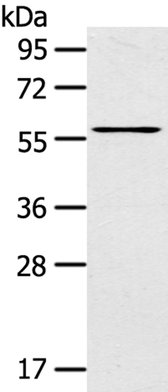 Rabbit Polyclonal Antibody to LPP