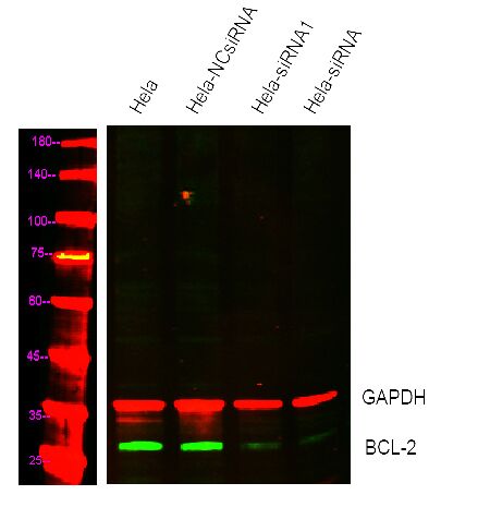 Mouse Monoclonal Antibody to Bcl-2