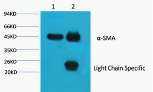 Rabbit Polyclonal Antibody to Cleaved-Plasma Kallikrein HC (R390)