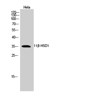 Rabbit Polyclonal Antibody to 11β-HSD1