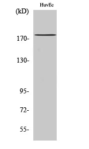 Rabbit Polyclonal Antibody to ABCA8