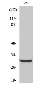 Rabbit Polyclonal Antibody to ABCC13
