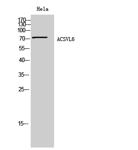 Rabbit Polyclonal Antibody to ACSVL6