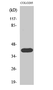 Rabbit Polyclonal Antibody to Actin α3