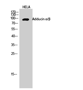 Rabbit Polyclonal Antibody to Adducin α/β