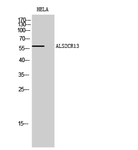 Rabbit Polyclonal Antibody to ALS2CR13