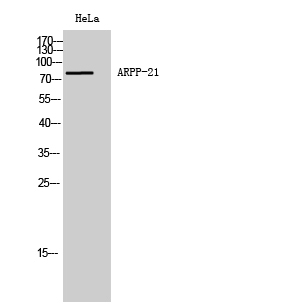 Rabbit Polyclonal Antibody to ARPP-21