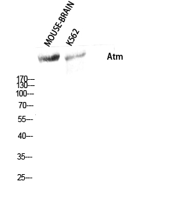 Rabbit Polyclonal Antibody to Atm