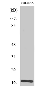 Rabbit Polyclonal Antibody to BET3