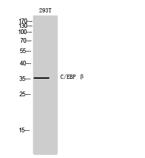 Rabbit Polyclonal Antibody to C/EBP β