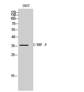 Rabbit Polyclonal Antibody to C/EBP β