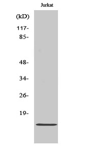Rabbit Polyclonal Antibody to Cdc42EP5
