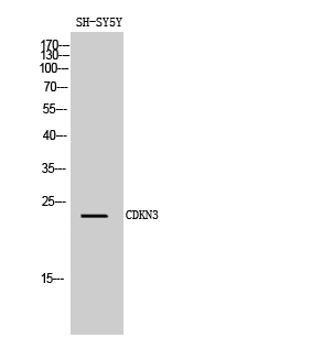 Rabbit Polyclonal Antibody to CDKN3