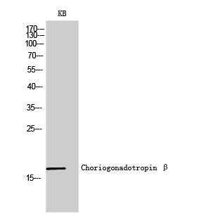 Rabbit Polyclonal Antibody to Choriogonadotropin β