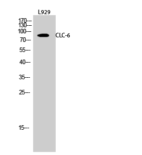 Rabbit Polyclonal Antibody to CLC-6