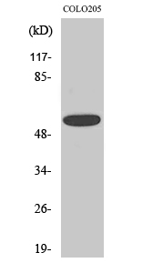 Rabbit Polyclonal Antibody to CLCC1