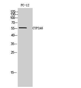Rabbit Polyclonal Antibody to CYP2A6