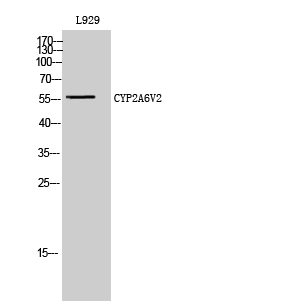 Rabbit Polyclonal Antibody to CYP2A6V2