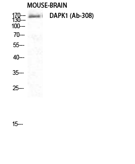 Rabbit Polyclonal Antibody to DAPK1