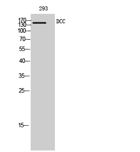 Rabbit Polyclonal Antibody to DCC