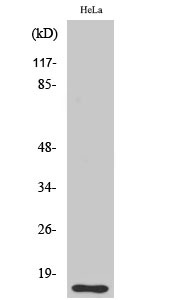 Rabbit Polyclonal Antibody to DOC-1