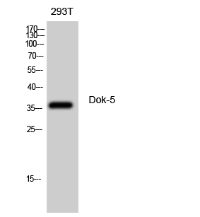 Rabbit Polyclonal Antibody to Dok-5