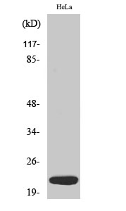 Rabbit Polyclonal Antibody to Dynein LC 1