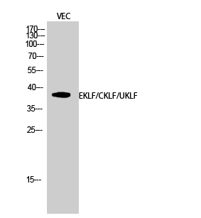 Rabbit Polyclonal Antibody to EKLF/CKLF/UKLF