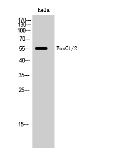 Rabbit Polyclonal Antibody to FoxC1/2